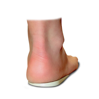 Warwick Heel Wedge by Core Products - COR104