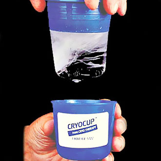 Cryocup Ice Massage Therapy by Cryo Therapy Inc - Singles - CRY100